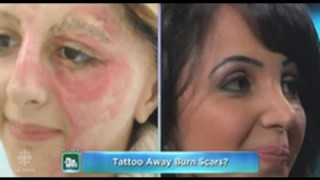 Amazing: Tattoo Artist Uses Ink To Cover Burn Victims Scars!