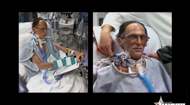 The World’s First Heartless Human Is Able To Live Without A Pulse!